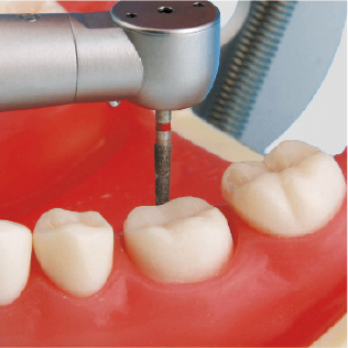 Modelo de Maxilar de Restauración Prostética (32 dientes) [PRO2001-UL-SCP-FEM-32]