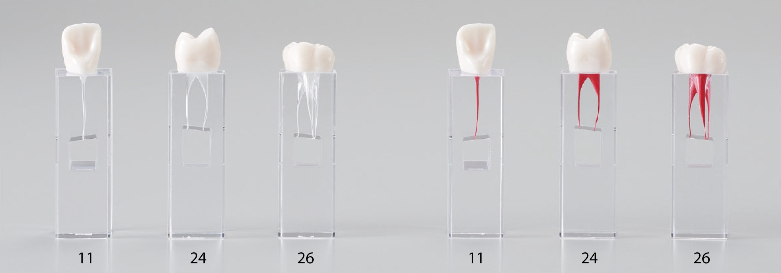 Modelo de Canal Radicular [Serie E-END3M]