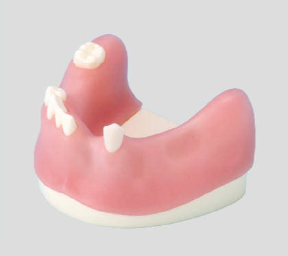 Modelo de Práctica de Injerto Oseo [IMP1009-L-SP]