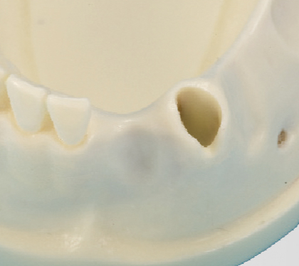 Modelo de Práctica de Injerto Oseo [IMP1009-L-SP]