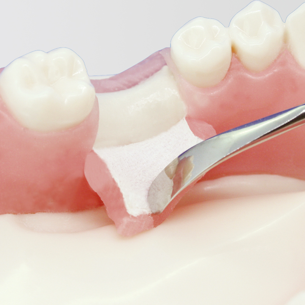 Modelo Básico para Práctica de Implantes [Serie IMP1034]