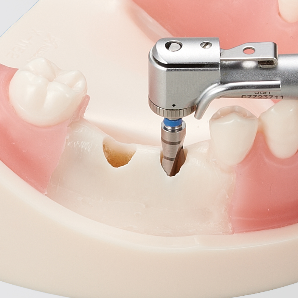 Modelo Básico para Práctica de Implantes [Serie IMP1034]