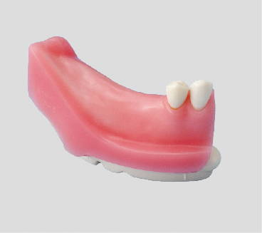 Socket de Recambio para Implantes [IMP5003-T]