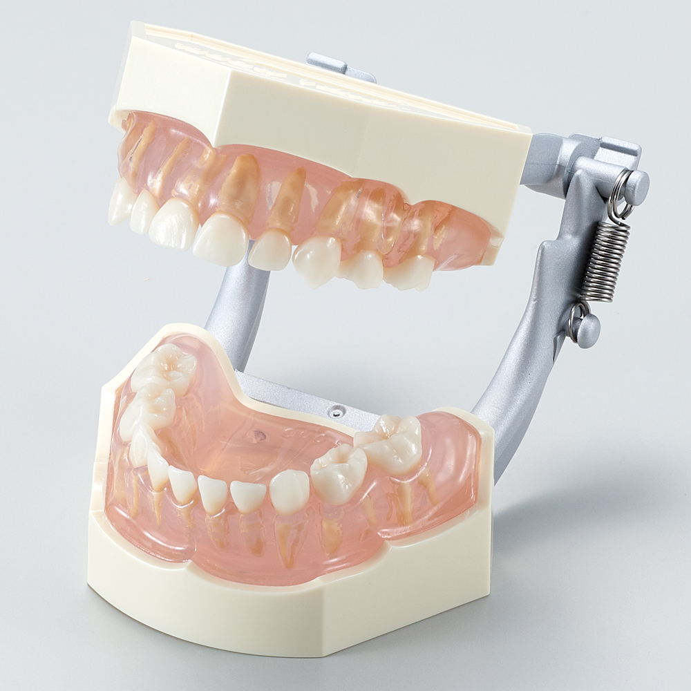 Modelo para Estudio con Dientes Retirables (Primarios) [PE-ANA003] (Encía de Silicona Rosa Transparente)