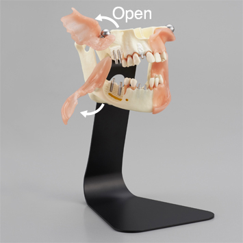 Modelo Extensivo para Asesoría sobre Implantes [PE-IMP007]