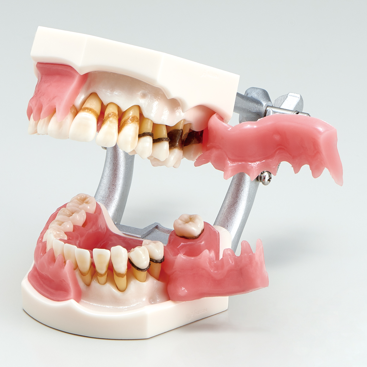 Modelo de Enfermedad Periodontal con movilidad dental [PE-PER003]