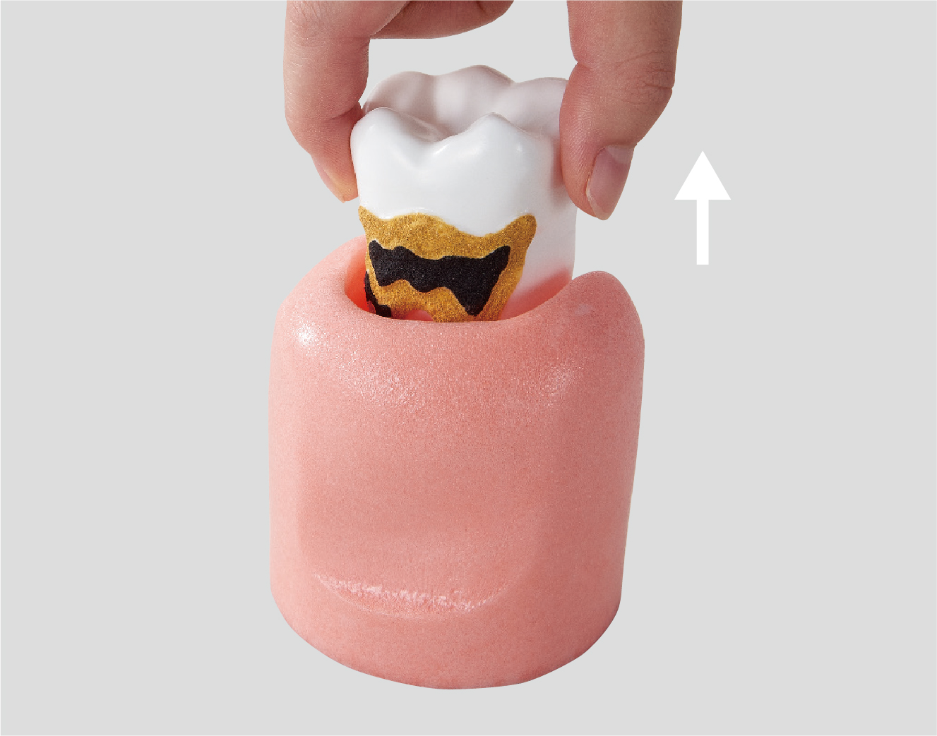 Modelo de Enfermedad Periodontal [PE-PER014]