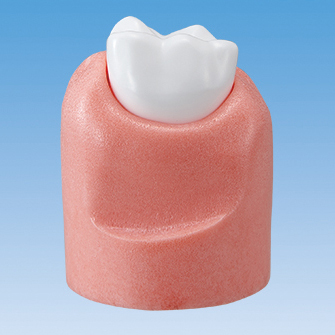 Modelo de Enfermedad Periodontal [PE-PER014]