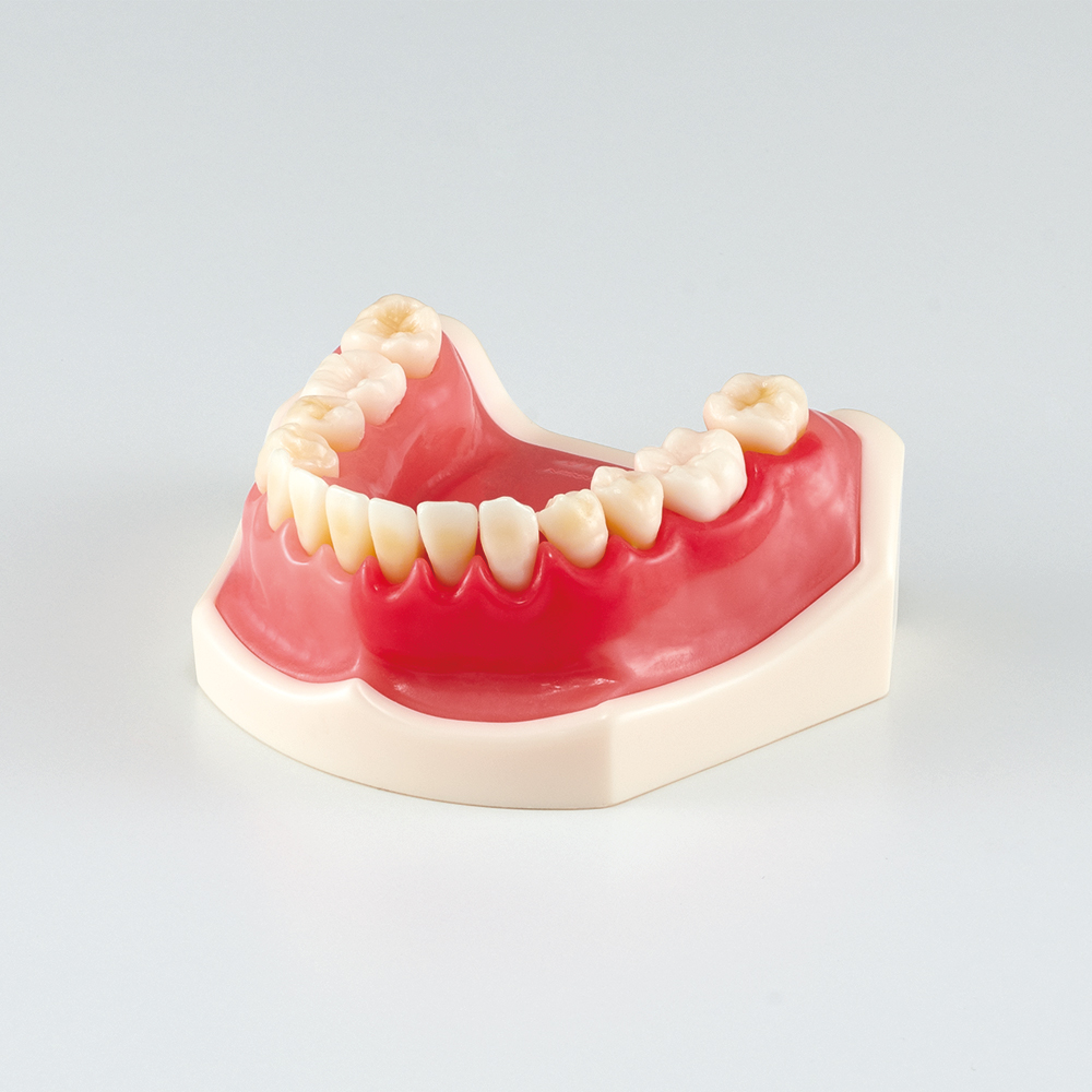 Modelo de Enfermedad periodontal y Peri-implantitis [PE-PER015]