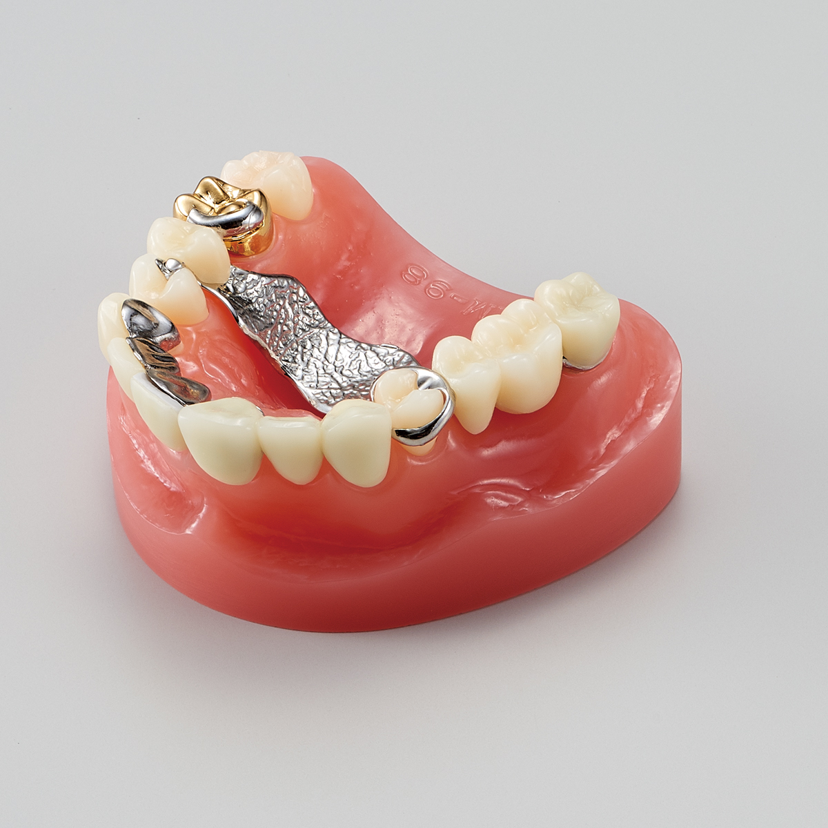 Modelo para Estudio de Prótesis/Restauración Dental  [PE-PRO002]