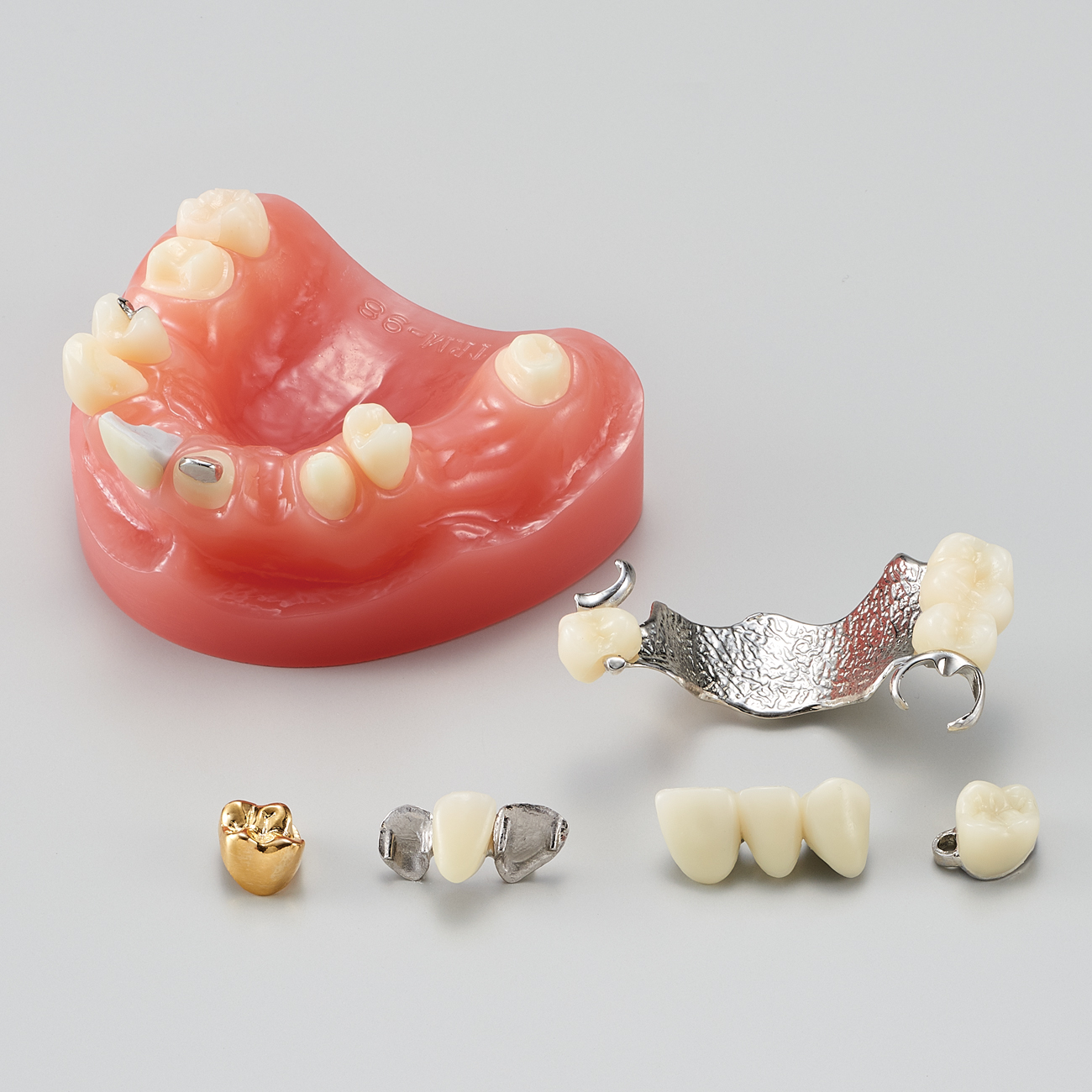 Modelo para Estudio de Prótesis/Restauración Dental  [PE-PRO002]