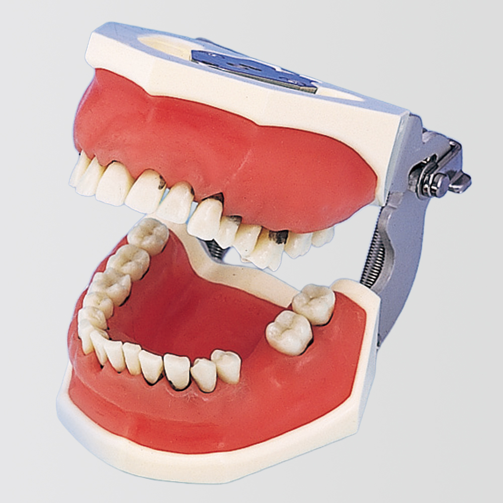 Modelo de Maxilar para Periodoncia [PER1001-UL-SP-FEM-32]