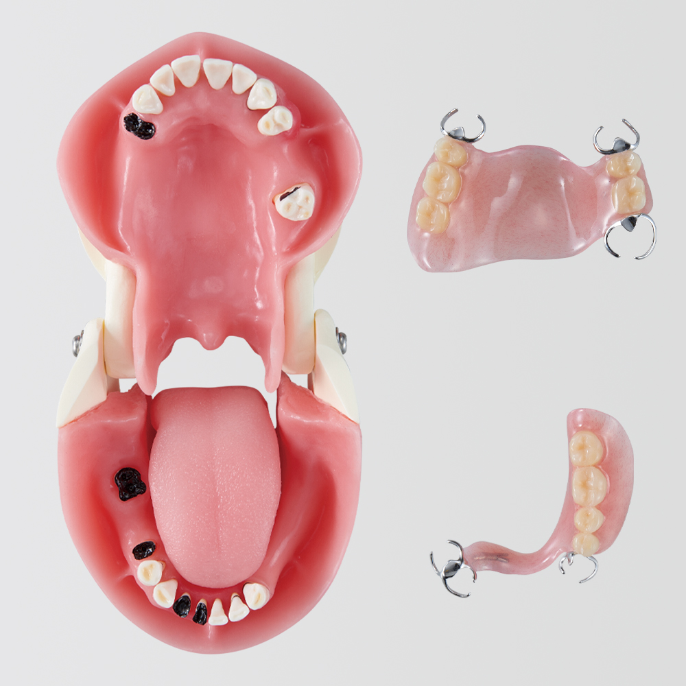 Modelo de Mandibula para la Práctica de Cuidado Oral (Caso de Hemiplegia)[OHC1011-UL-SP]