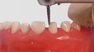Área de Cirujía Periodontal