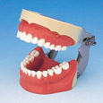 Modelo de maxilar para infiltración de anestesia [SUG1004-UL-SP-FEM-28]