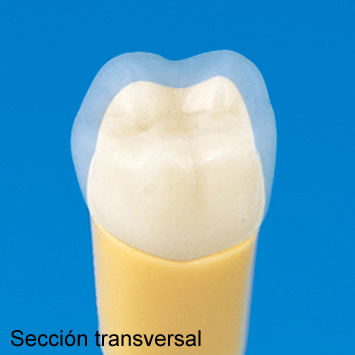 Modelo de Diente de 2 Capas [A20A-500]