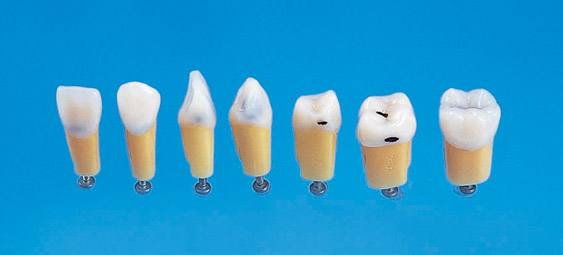 Caries Tooth Model [A27A Series]