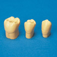 4X Size Resin Tooth Model [C3-304]